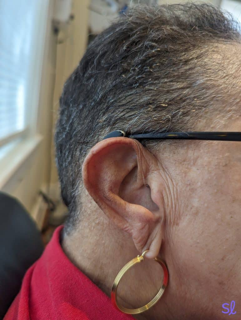 A patient wearing Signia Styletto hearing aids