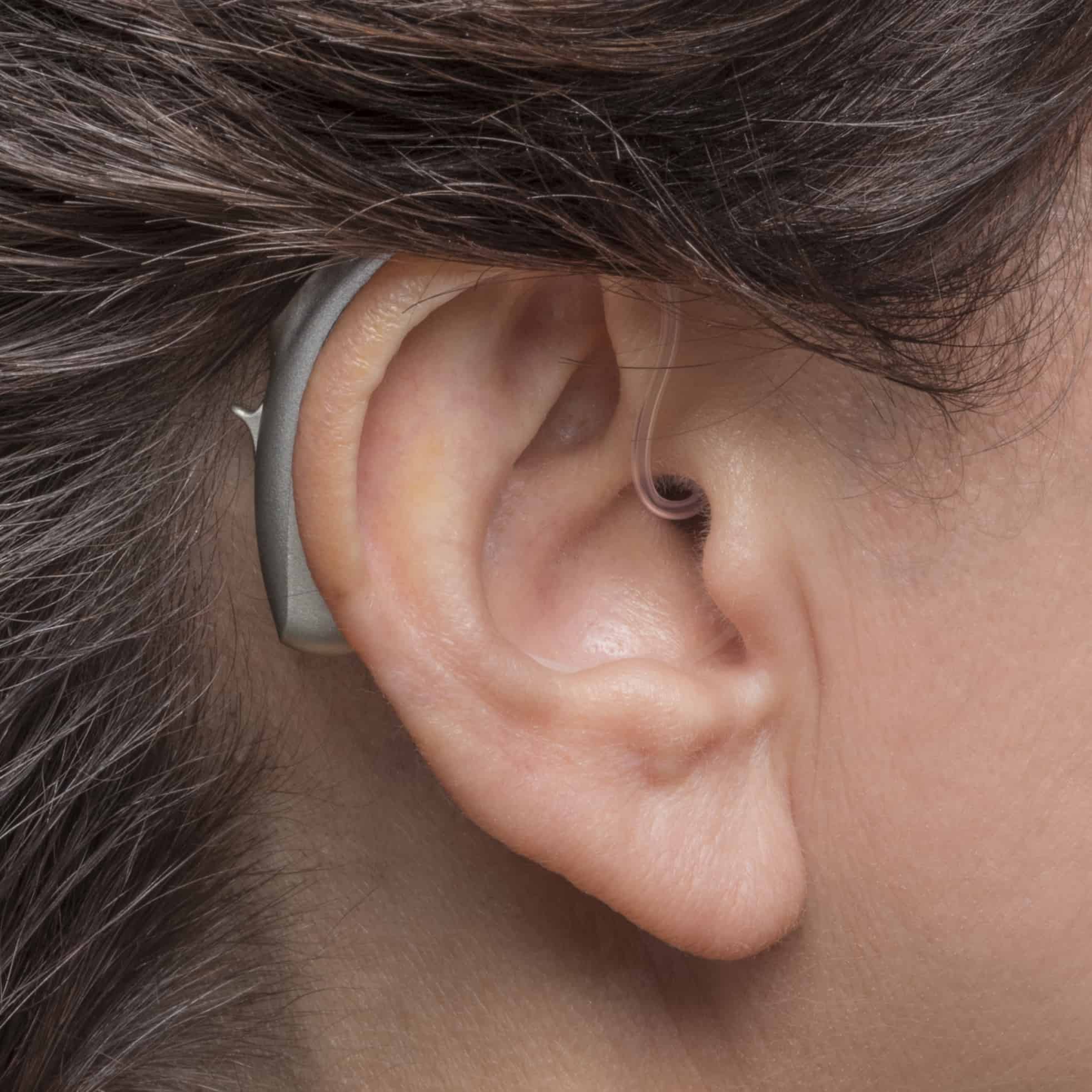Phonak - BTE hearing aids. Photo credit - Phonak