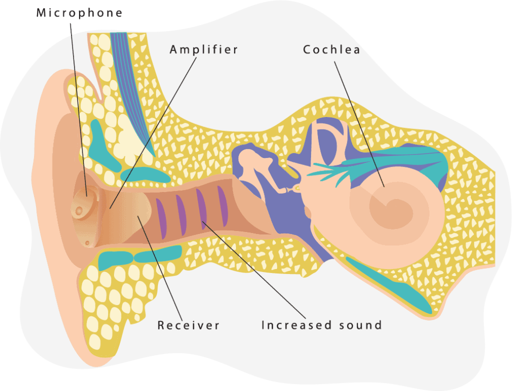 hearing-aid-diagram