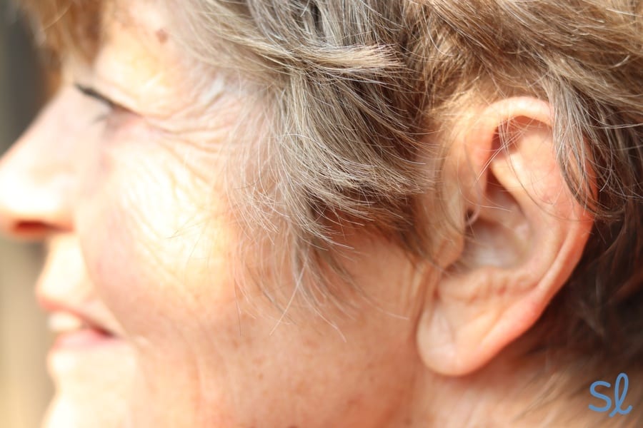 Our editor's grandma wearing her BTE hearing aids; you can barely see them!