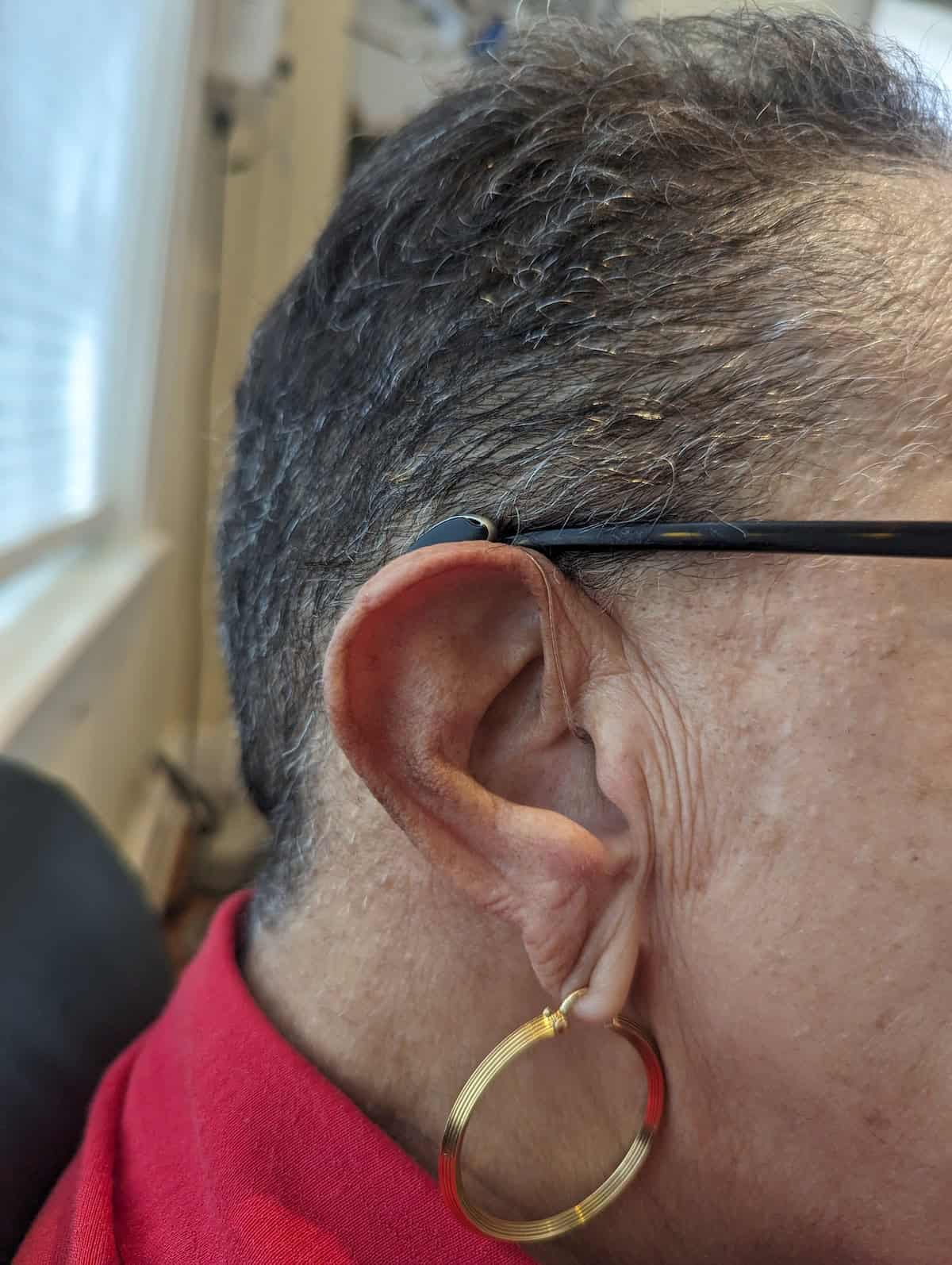 Hearing aid patient